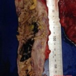 Autopsy of Japanese man who choked on sushi roll