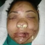 Breathtaking facial reconstruction of woman after car accident