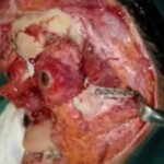 Breathtaking facial reconstruction of woman after car accident