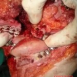 Breathtaking facial reconstruction of woman after car accident