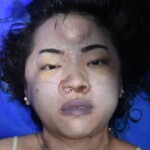 Dead woman pulled from submerged car