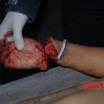 Discovery of murdered Chinese woman with chopped of hand