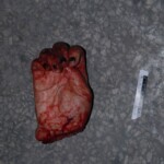 Discovery of murdered Chinese woman with chopped of hand