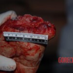 Discovery of murdered Chinese woman with chopped of hand