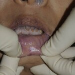 Examination of dead Chinese woman