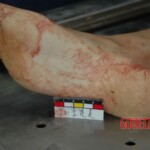 Female victim of machete murder in China