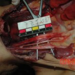 Female victim of machete murder in China