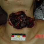 Female victim of machete murder in China