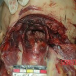 Female victim of machete murder in China