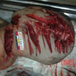 Female victim of machete murder in China