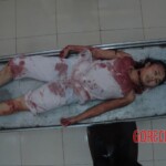 Female victim of machete murder in China