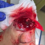 His dog ate his big toe while he was sleeping