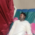 Indian guy suffered severe burns from suicide attempt