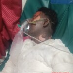 Indian guy suffered severe burns from suicide attempt