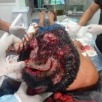 Indigenous community chief in Amazon mauled by jaguar