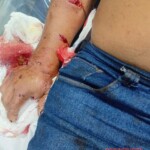 Indigenous community chief in Amazon mauled by jaguar