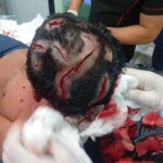 Indigenous community chief in Amazon mauled by jaguar