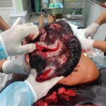 Indigenous community chief in Amazon mauled by jaguar