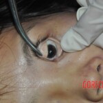 Initial examination of hanged Chinese woman