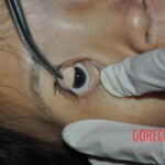 Initial examination of hanged Chinese woman