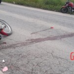 Intestines of motorcyclist flew out in accident