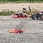 Intestines of motorcyclist flew out in accident