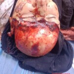 Iraqi man scalped in work accident