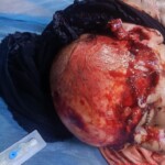 Iraqi man scalped in work accident