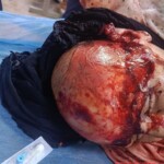 Iraqi man scalped in work accident