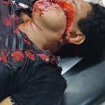 Machete murder of man, followed by attempted murder of woman