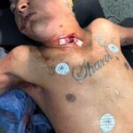 Man mutilated by bull during Corralejas festival