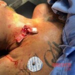 Man mutilated by bull during Corralejas festival