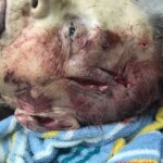 Mentally ill woman cut herself with knife and jumped to her death