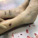 Mentally ill woman cut herself with knife and jumped to her death