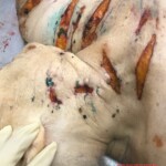 Mentally ill woman cut herself with knife and jumped to her death