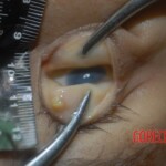 Stabbed Chinese woman in morgue