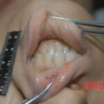 Stabbed Chinese woman in morgue