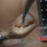 Stabbed Chinese woman in morgue