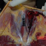 Stabbed Chinese woman in morgue