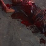 Stabbed by his wife with kitchen knife