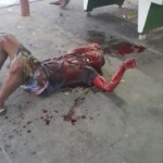 Stabbed by his wife with kitchen knife