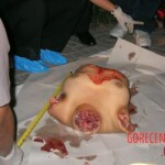 Terrifying discovery of dismembered Chinese woman