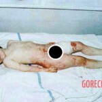 Victims of NATO’s bombing of Yugoslavia