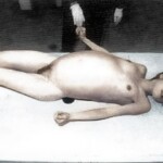 Young woman died from constipation