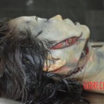 Examination and autopsy of female victim of machete attack