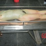 Examination and autopsy of female victim of machete attack