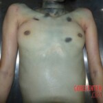 Examination and autopsy of female victim of machete attack