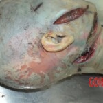 Examination and autopsy of female victim of machete attack