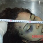 Examination and autopsy of female victim of machete attack