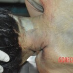 Examination and autopsy of female victim of machete attack